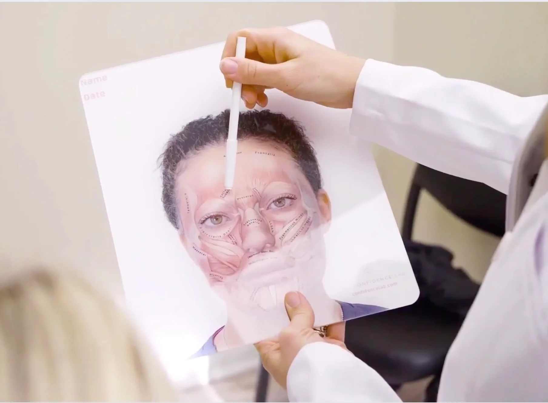 Kybella