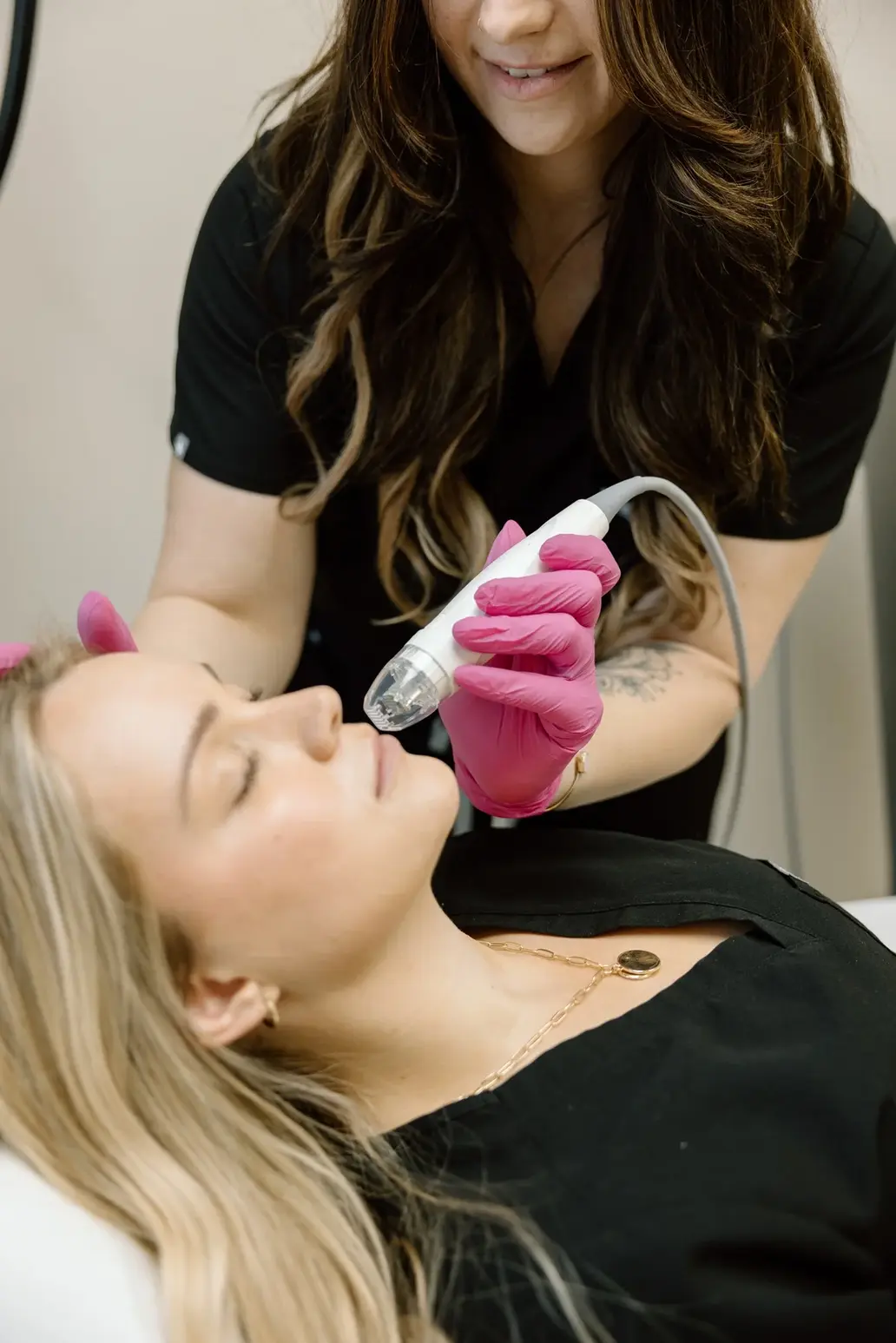 Microneedling