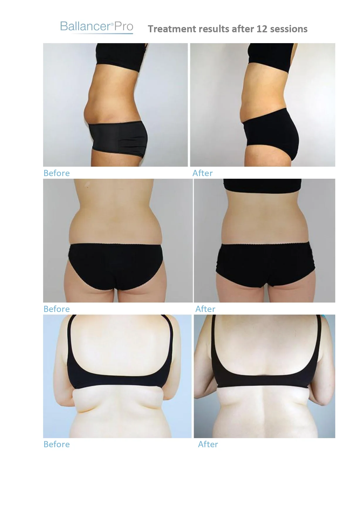 Before-After-BallancerPro