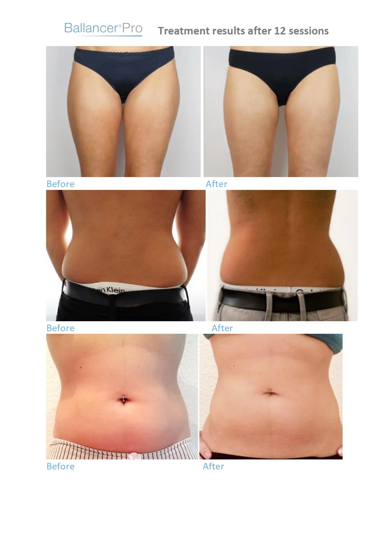 Before-After-BallancerPro