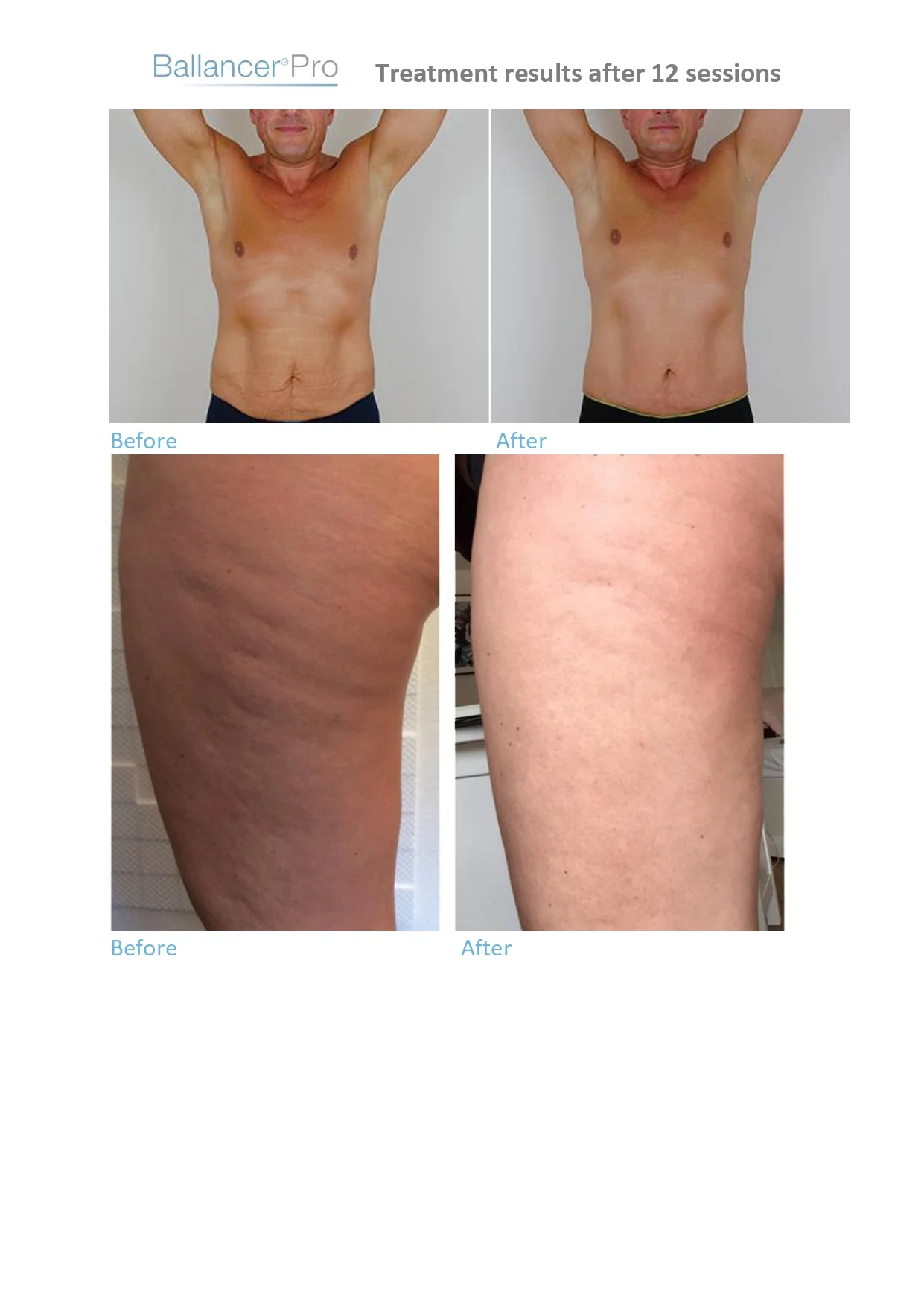 Before-After-BallancerPro
