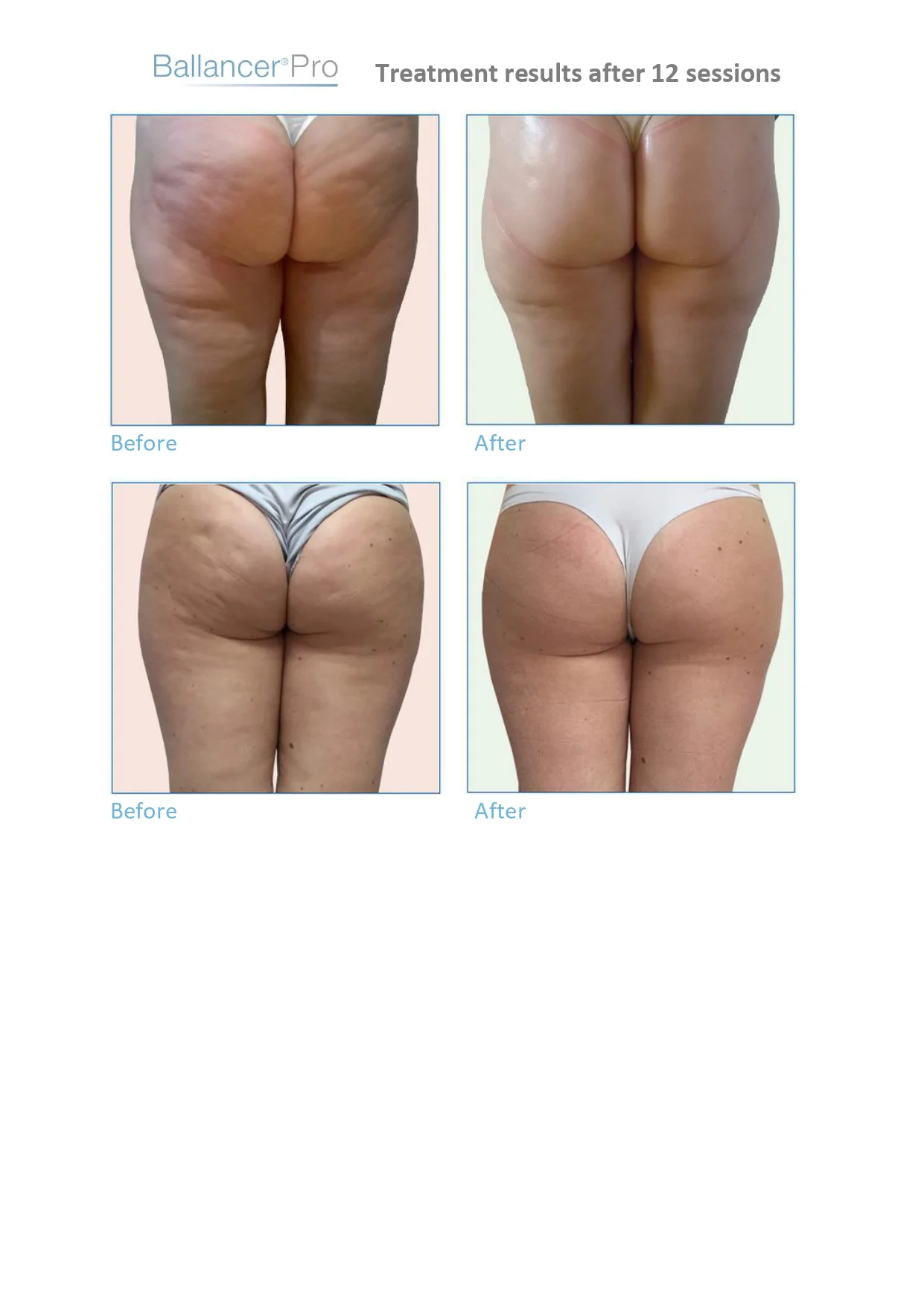 Before-After-BallancerPro