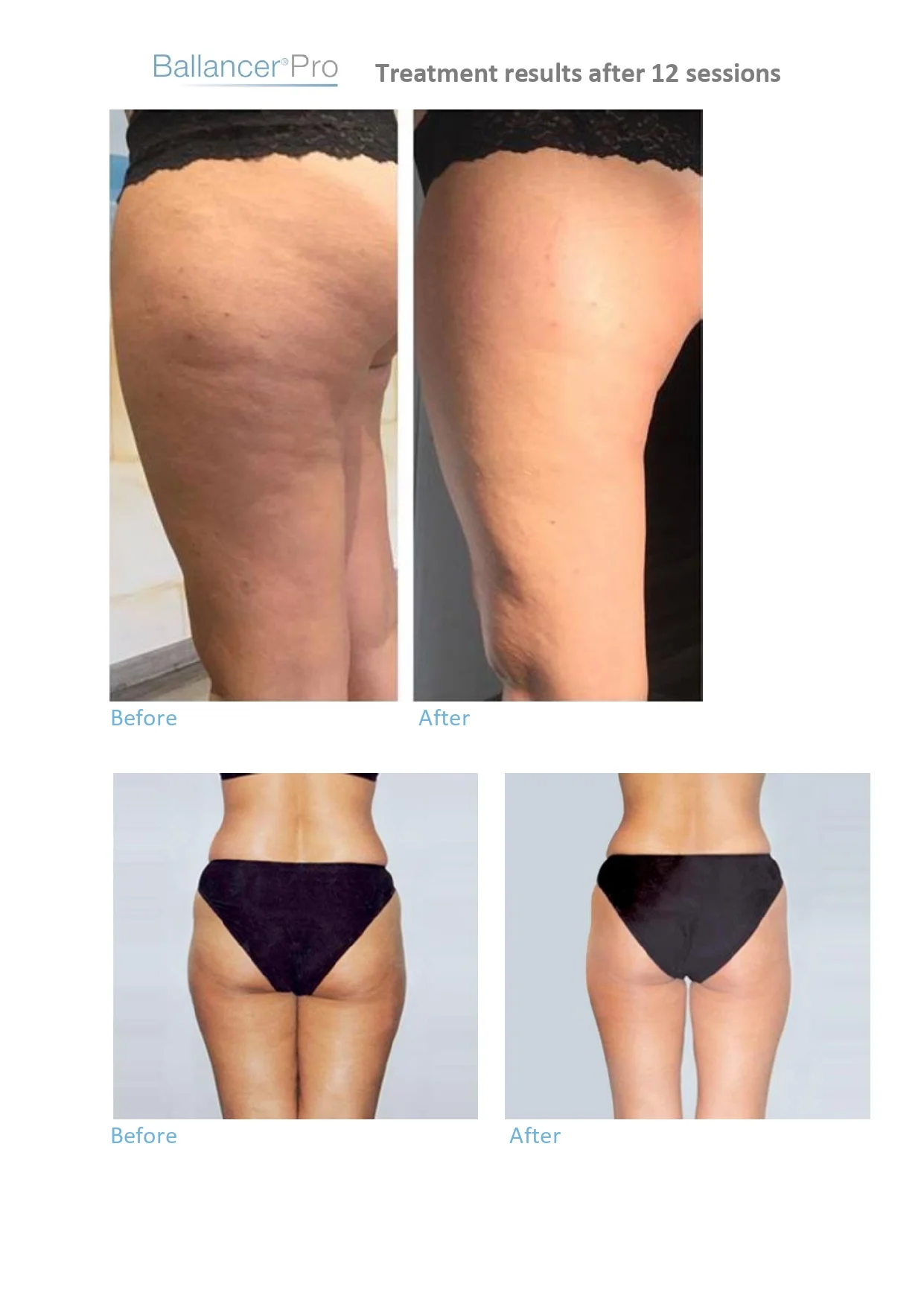 Before-After-BallancerPro