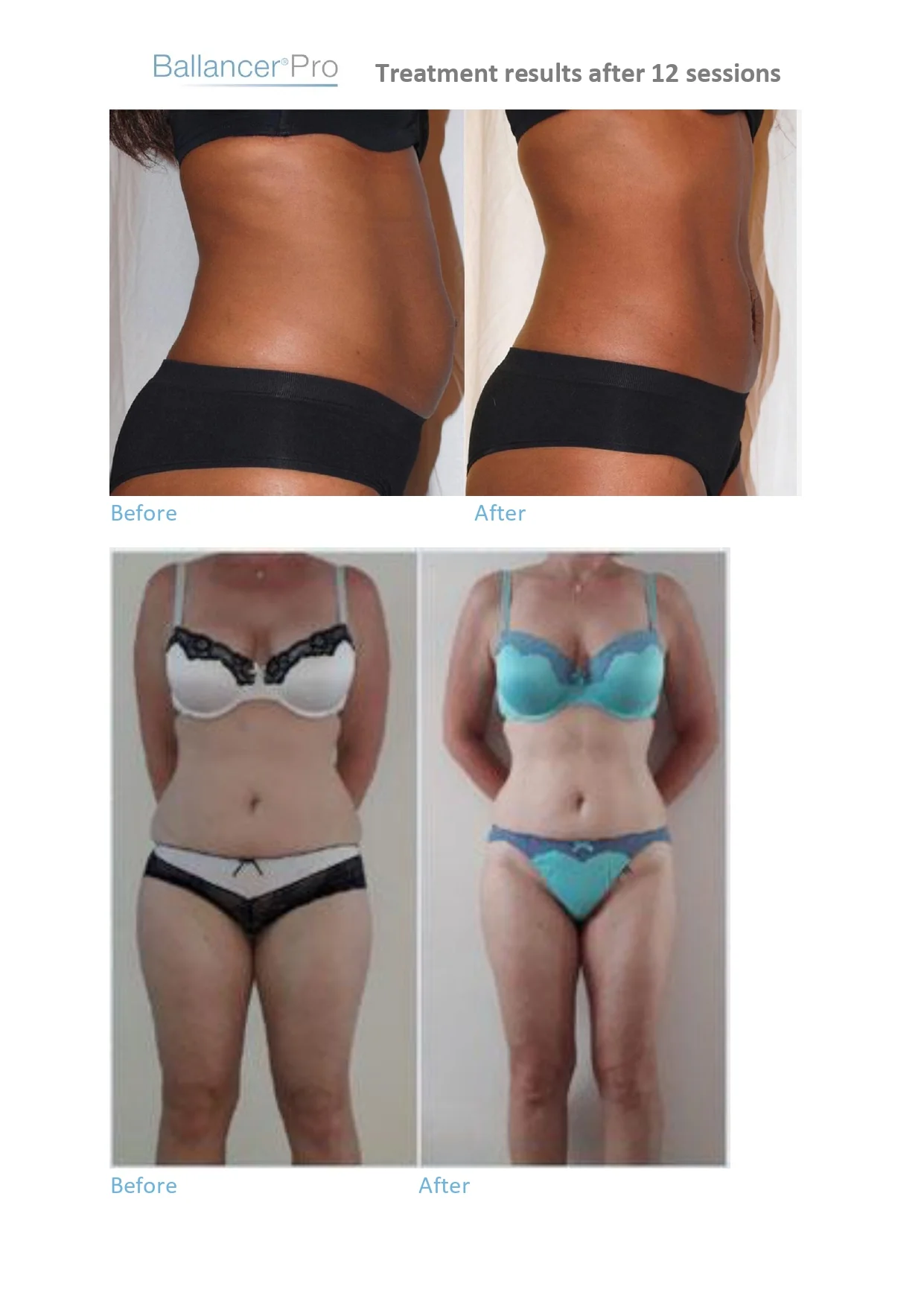 Before-After-BallancerPro