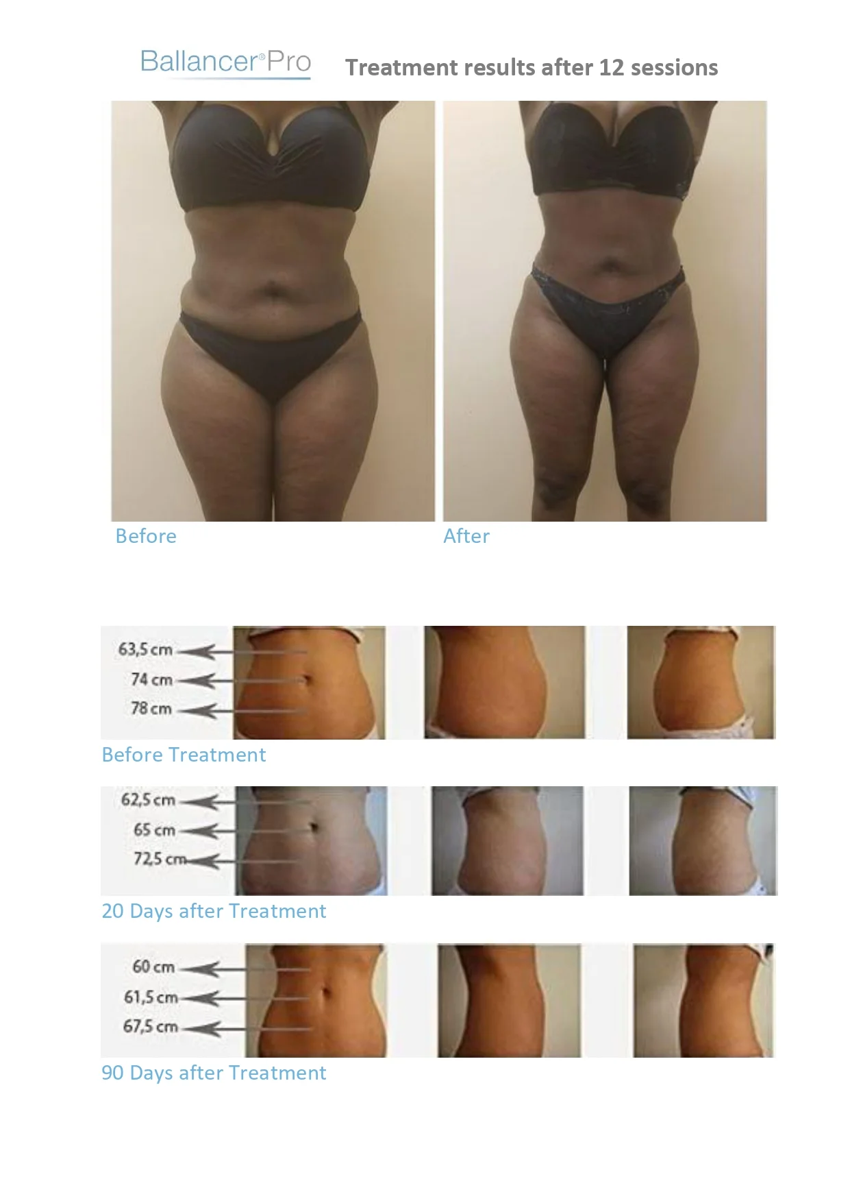 Before-After-BallancerPro